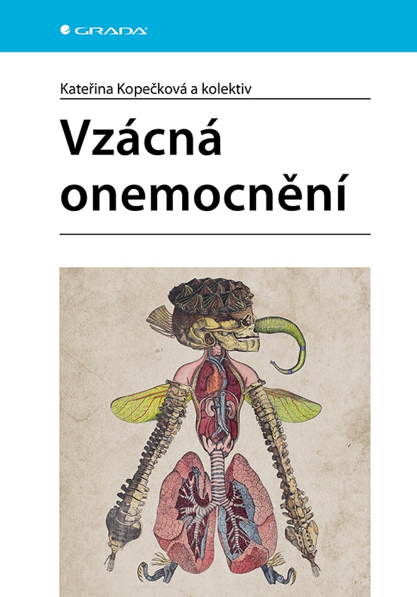 Kniha: Vzácná onemocnění od Kopečková Kateřina