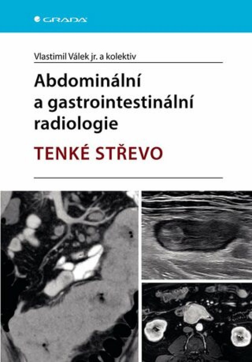 Abdominální a gastrointestinální radiologie - e-kniha