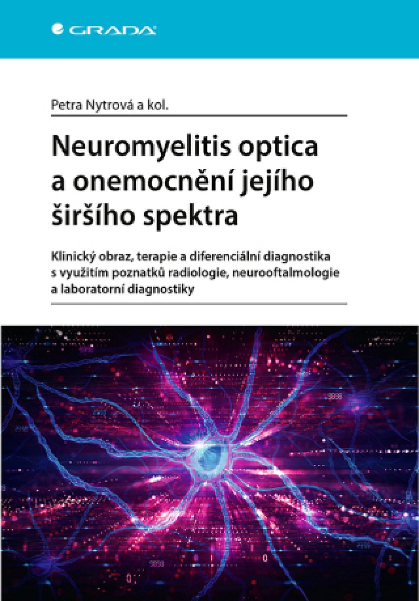 Neuromyelitis optica a onemocnění jejího širšího spektra - Petra Nytrová - e-kniha